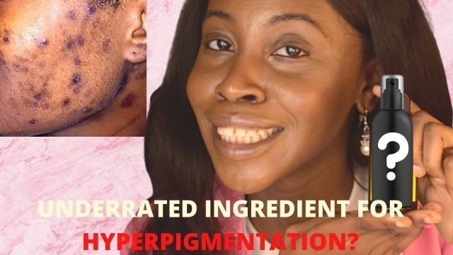 'How to Treat Hyperpigmentation on Dark Skin with Korean Skincare Products @stylevana |Alpha Arbutin'
