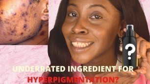 'How to Treat Hyperpigmentation on Dark Skin with Korean Skincare Products @stylevana |Alpha Arbutin'