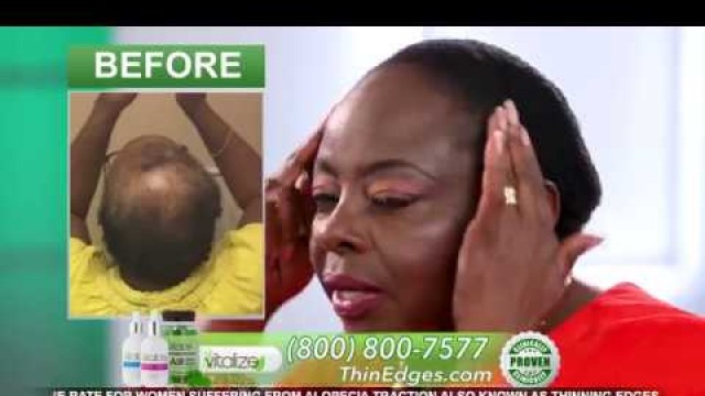 'Vitalize Hair System Dorothy Horn Real User'