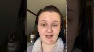 'girl covers acne & dark circles with makeup (tik tok)'