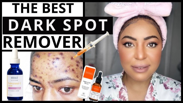 'The Game Changer | VITAMIN C For Hyperpigmentation Routine| Dark Spot Remover'