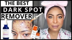 'The Game Changer | VITAMIN C For Hyperpigmentation Routine| Dark Spot Remover'