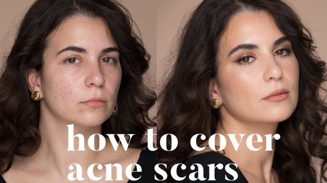 'HOW TO COVER ACNE SCARS | ALI ANDREEA'