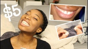'Brain Food #2: How To Close Your Gap with Rubber Bands'