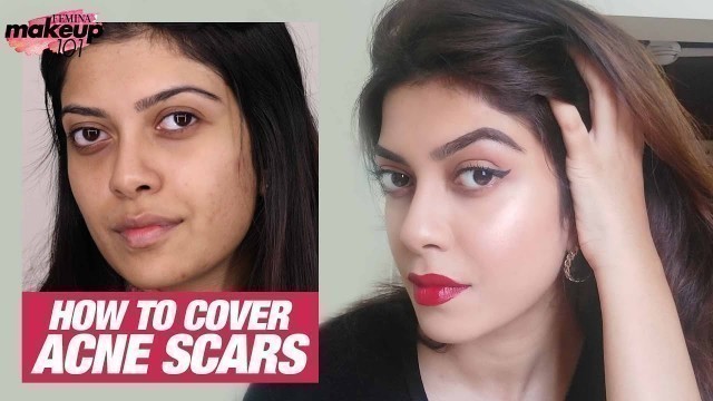 'How To Cover Acne Scars & Pimple Marks With Makeup | Full Coverage Makeup | Makeup 101 | Femina'