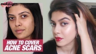 'How To Cover Acne Scars & Pimple Marks With Makeup | Full Coverage Makeup | Makeup 101 | Femina'