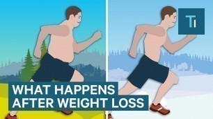 'What Losing Weight Does To Your Body And Brain | The Human Body'