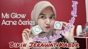 'Review Skincare Ms Glow Acne Series - Skincare Penghilang Jerawat'
