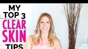 'How To Get Rid of Acne + How To Get Clear Skin FAST | My Top 3 Tips for Smooth, Beautiful Skin!'