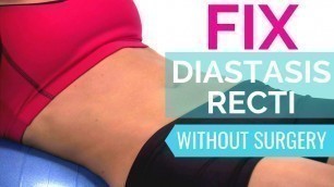 'How To Fix Diastasis Recti | Heal Diastasis Recti Naturally Without Surgery'