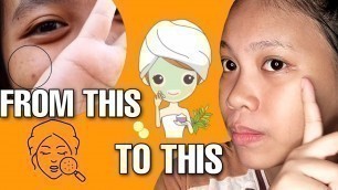 'MY SKINCARE ROUTINE |GLOWING KA SIS |Amera Fiedacan'
