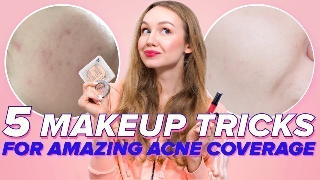 '5 Makeup Tricks For Acne (how to cover acne marks and feel comfortable in your skin)'
