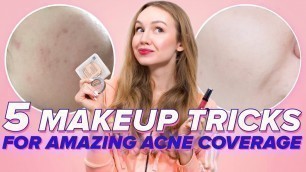 '5 Makeup Tricks For Acne (how to cover acne marks and feel comfortable in your skin)'