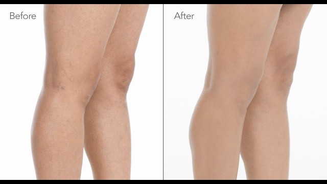 'How to Cover Spider Veins on Legs with Makeup | jane iredale'