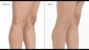 'How to Cover Spider Veins on Legs with Makeup | jane iredale'