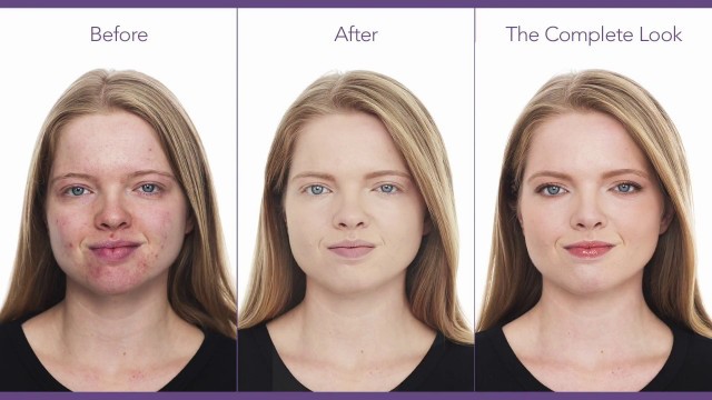 'Cover Acne & Scars: Makeup Tutorial for Acne | jane iredale'