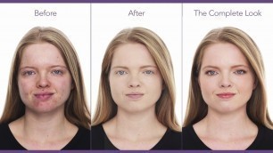 'Cover Acne & Scars: Makeup Tutorial for Acne | jane iredale'