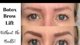 'Get The Look Of A BOTOX BROW LIFT Using Makeup | Full Eyebrow Tutorial'