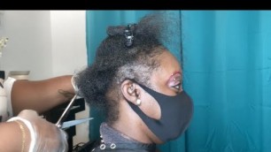 'How to fix damaged hair| Wearing wigs for a long time damaged her hair line'