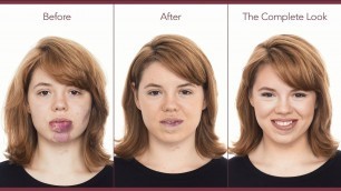 'Makeup to Hide Port Wine Stains & Birthmarks | jane iredale'
