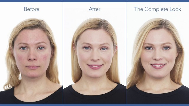 'Redness & Rosacea Camouflage Makeup Tutorial | jane iredale'