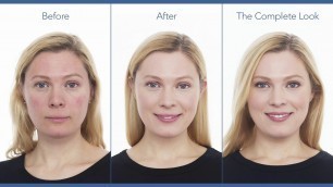 'Redness & Rosacea Camouflage Makeup Tutorial | jane iredale'