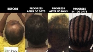 'Vitalize 100% Natural Hair Growth Treatment'