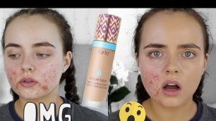 'TARTE SHAPE TAPE FOUNDATION REVIEW | ACNE PRONE SKIN | Conagh Kathleen'