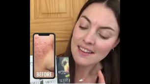 'Acne? Pimples? Wrinkles? These products changed my life! | Emani Vegan Cosmetics'