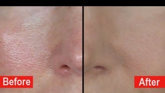 'How To Hide Large Pores! Poreless Mini-Bake Foundation Tutorial'