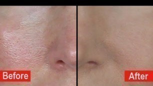 'How To Hide Large Pores! Poreless Mini-Bake Foundation Tutorial'