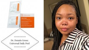 'Dr. Dennis Gross Universal Daily Peel | 5 Day Review | Vonshay'