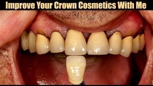 'Improve Your Crown Cosmetics With Me'