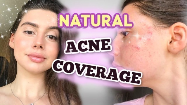 'HOW TO COVER UP ACNE NATURALLY W/ MAKEUP || GOLDEN HOUR with acne Tutorial , UPDATED MAKEUP ROUTINE!'
