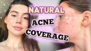 'HOW TO COVER UP ACNE NATURALLY W/ MAKEUP || GOLDEN HOUR with acne Tutorial , UPDATED MAKEUP ROUTINE!'