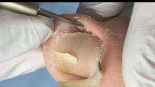 'Deep clean for nails'