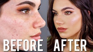 'Cover ACNE with DRUGSTORE Makeup & Brushes! FULL COVERAGE Foundation'