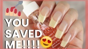 '5 PRODUCTS THAT SAVED MY NAILS!!'
