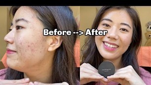 'HOW TO COVER ACNE with the BareMinerals Original Powder Foundation and Look Like a Natural Beauty'