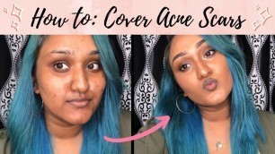 'How to cover Acne Scars (Full Coverage Makeup)'