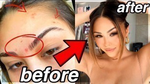 'How To Conceal Acne/Acne Scars *flawless foundation routine* | Roxette Arisa'