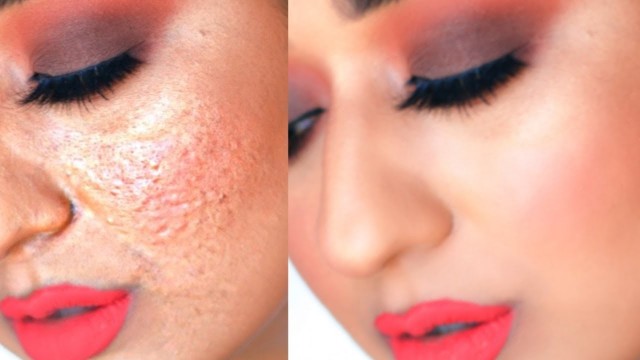 'HOW TO: Hide Enlarged PORES WITH MAKEUP and MAKE PORES DISAPPEAR Oily Skin'