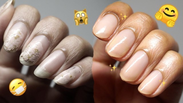 'Bye Busted Nails 