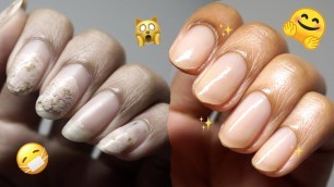 'Bye Busted Nails 