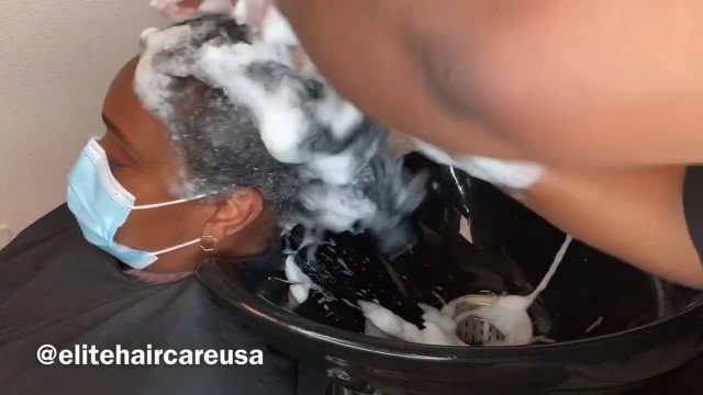 'She had dandruff and we removed it'