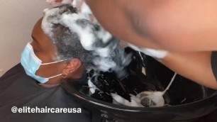 'She had dandruff and we removed it'