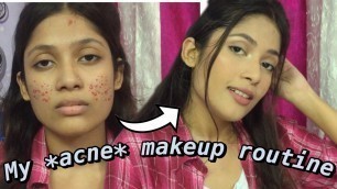 'Flawless Makeup Routine For Acne Scars Without Full Coverage Foundation (Non Cakey Base Routine)'