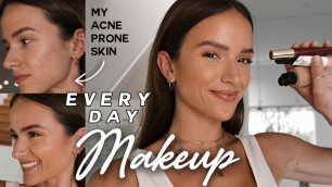 'My Makeup Routine | acne prone skin + covering scars'