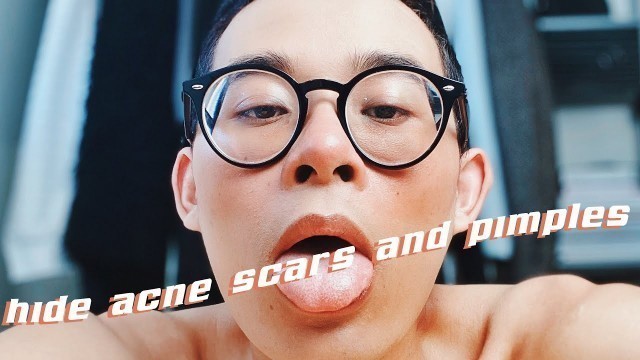 'Quickly Hide Acne Scars and Pimples with Simple + Natural Makeup for Beginners'
