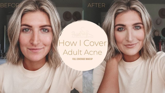 'HOW I COVER ADULT ACNE | Tips for full coverage foundation'